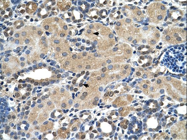Junctin / ASPH Antibody (aa66-115)