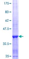 Human LGI2 Protein (Recombinant GST, N-terminus)