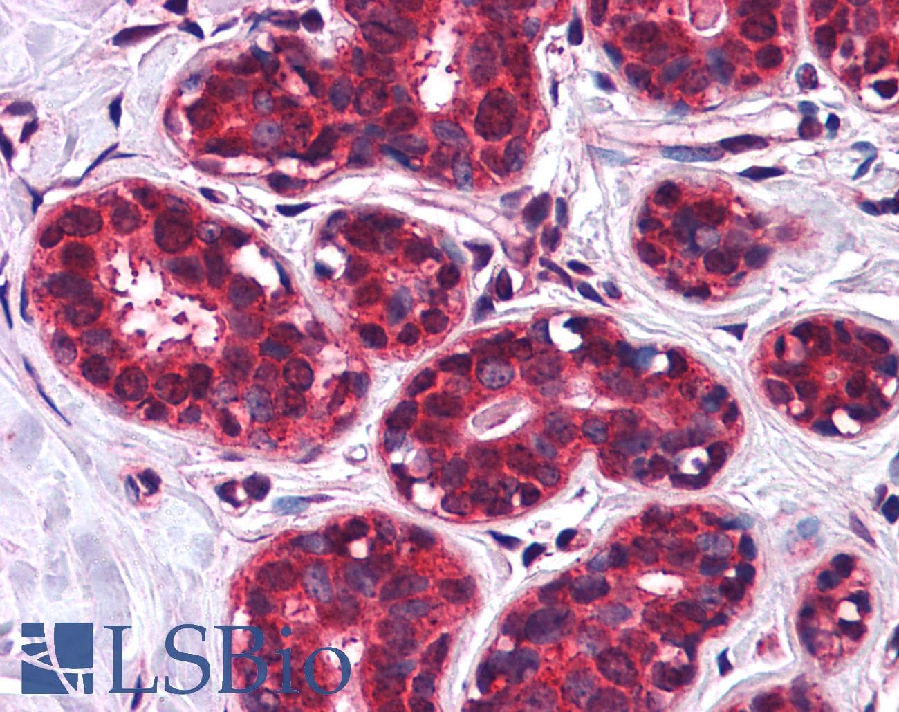 IHC-plus™ SLC5A6 / SMVT Antibody (Internal)