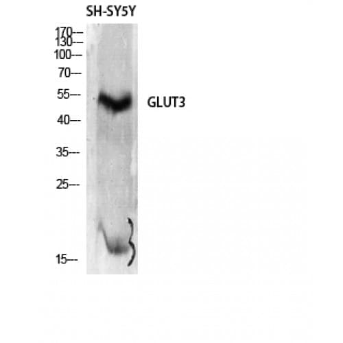Polyclonal Rabbit anti-Human SLC2A3 / GLUT3 Antibody (420-500 aa, C-terminal, IHC, WB)
