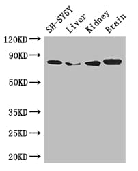 CHAT Antibody