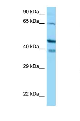 Polyclonal Rabbit anti-Human CABP / CABP1 Antibody (aa108-157, WB)