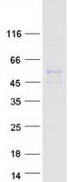 Human SLC22A18 Protein (Recombinant Myc-DDK (Flag))
