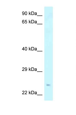 Amisyn / STXBP6 Antibody (N-Terminus)