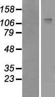 IRS2 / IRS-2 Protein (Over-Expression Lysate Myc-DDK (Flag))