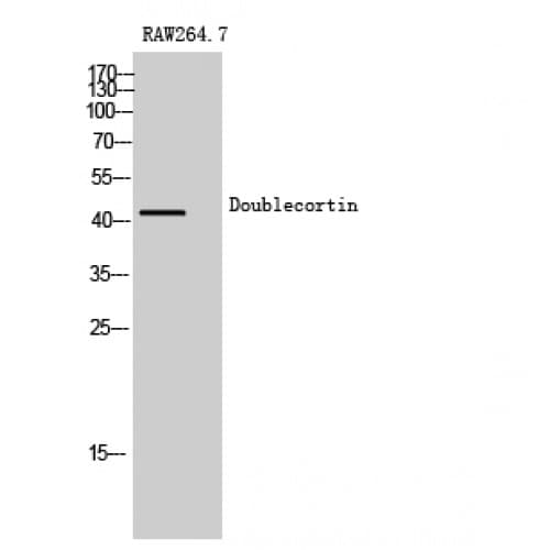 DCX / Doublecortin Antibody (180-260 aa)
