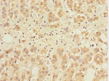 GABARAPL1 / ATG8 Antibody