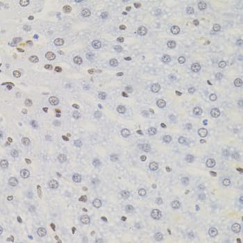 Polyclonal Rabbit anti-Human AKAP8 / AKAP95 Antibody (AP, IHC, WB)