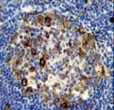 RPS6 / Ribosomal Protein S6 Antibody (Ser240/244)