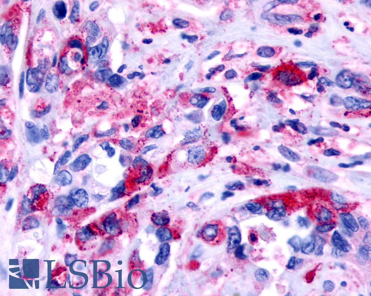 IHC-plus™ Polyclonal Rabbit anti-Human F2RL2 / PAR3 Antibody (C-Terminus, IHC)