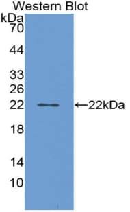 Prostaglandin D Synthase Antibody (aa32-190)