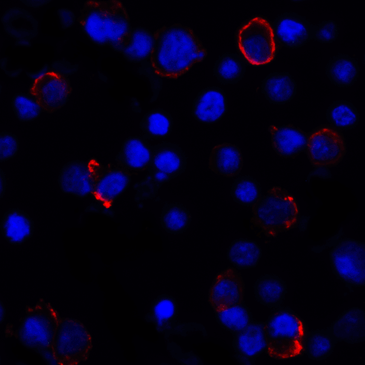 Monoclonal Mouse anti-Human CD274 / B7-H1 / PD-L1 Antibody (clone 4F2, IHC, IF, WB)