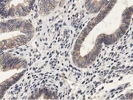 Monoclonal Mouse anti-Human GPR49 / LGR5 Antibody (clone OTI2H7, aa250-550, IHC, IF, WB)