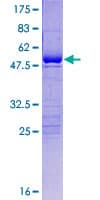 Human USP53 Protein (Recombinant GST)