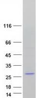 Human Dynactin 3 / DCTN3 Protein (Recombinant Myc-DDK (Flag))