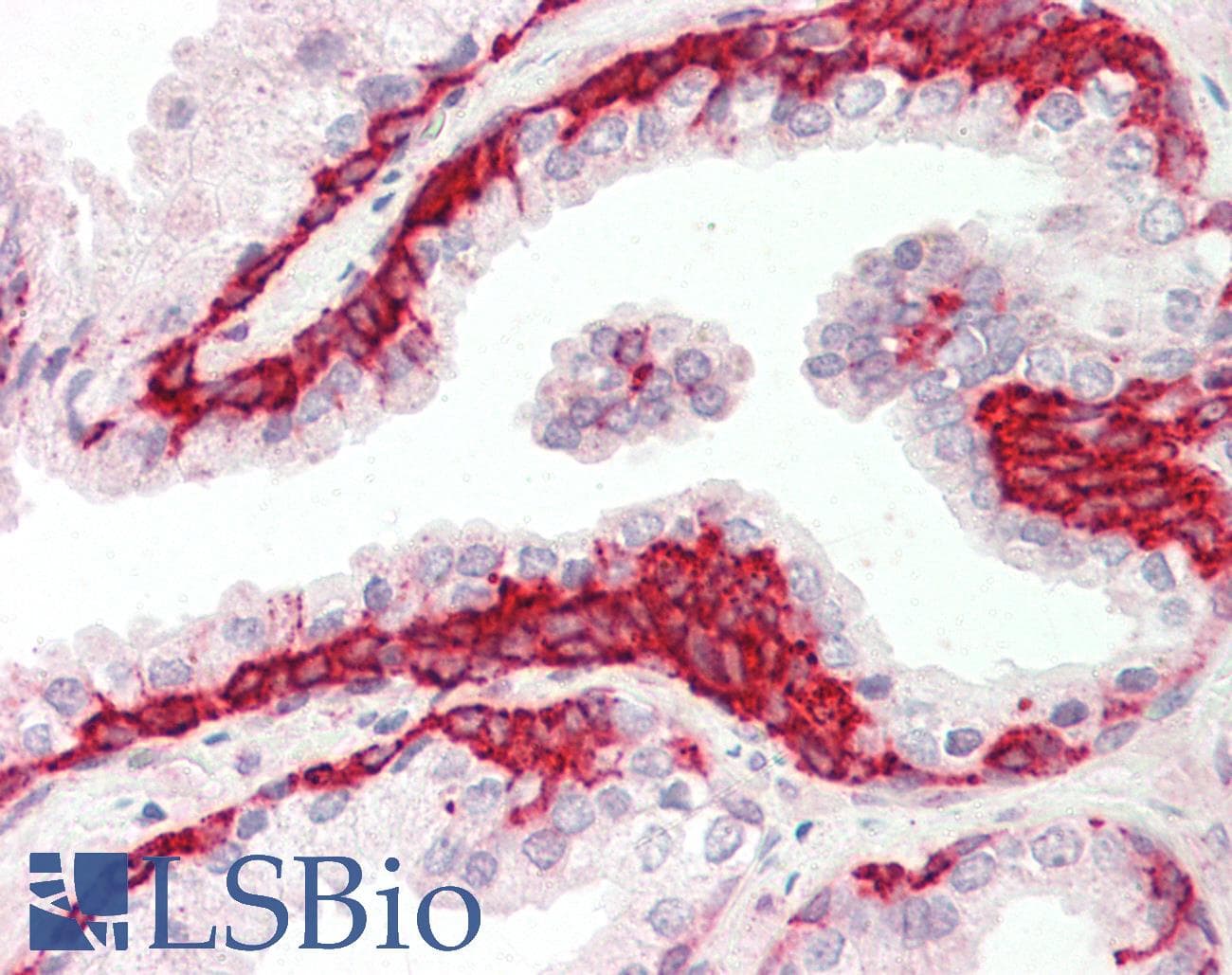 SMPD1 / Acid Sphingomyelinase Antibody (aa396-445)