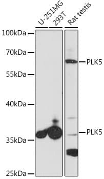 Polyclonal Rabbit anti-Human PLK5 Antibody (WB)