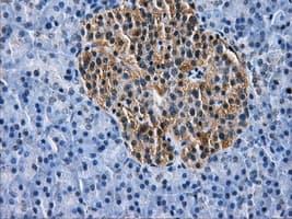 HDAC10 Antibody (clone OTI5A1)