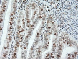 ERCC1 Antibody (clone 2.00E+12, Carrier-free)