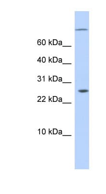 ARID5A Antibody (N-Terminus)