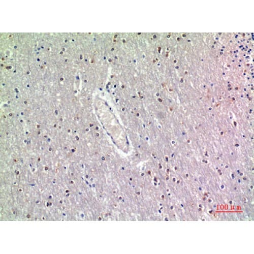 Polyclonal Rabbit anti-Human BMP12 / GDF7 Antibody (321-370 aa, Internal, IHC, WB)