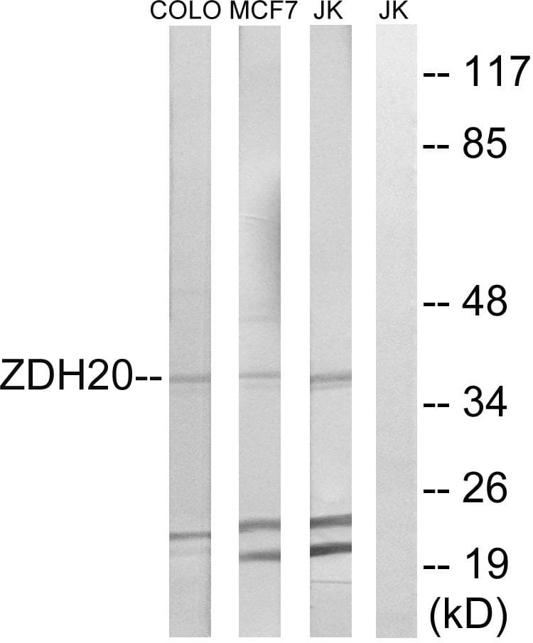 Polyclonal Rabbit anti-Human ZDHHC20 Antibody (WB)