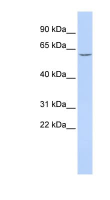 Polyclonal Rabbit anti-Human Carboxylesterase 5A / CES5A Antibody (aa396-445, WB)