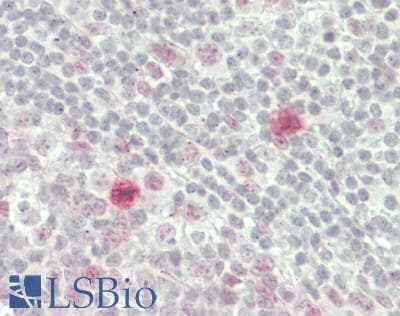 IHC-plus™ Monoclonal Mouse anti-Human PKN1 Antibody (clone 1A4, IHC, WB)