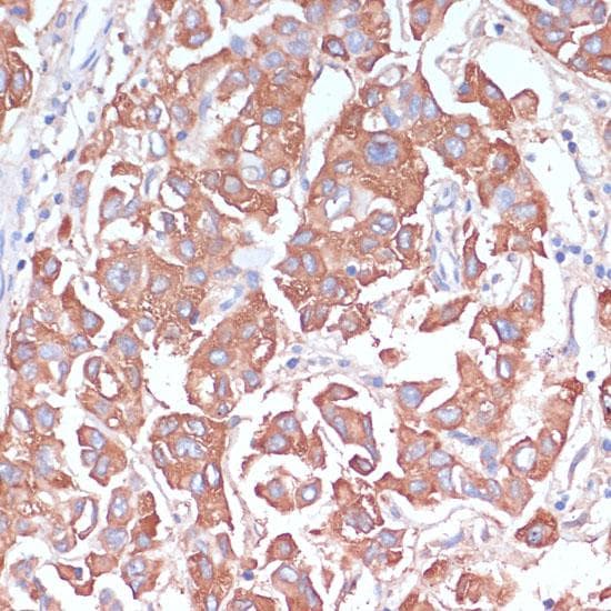 LRP1 / CD91 Antibody