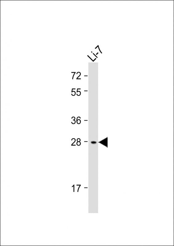 IGFBP1 Antibody (Internal)