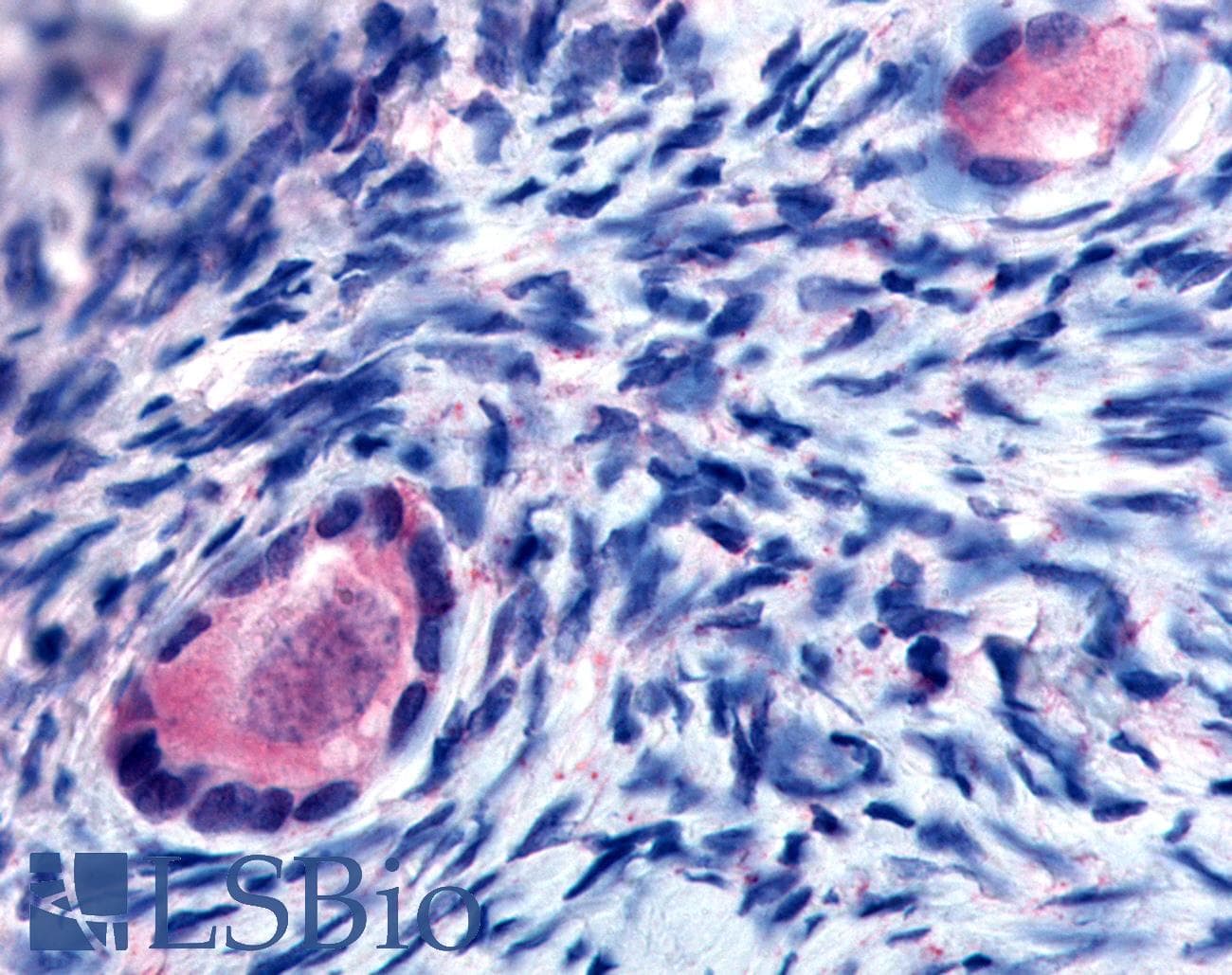 IHC-plus™ TMEM5 Antibody (Extracellular Domain)