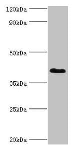 DHRS7 Antibody (aa29-339)