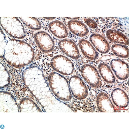 ATM Antibody