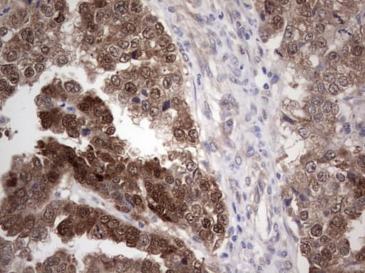 PIK3CA / PI3K Alpha Antibody (aa303-631, clone OTI6D1)