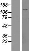 TONSL Protein (Over-Expression Lysate Myc-DDK (Flag))