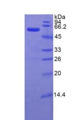 Rat ITIH4 Protein (Recombinant His-GST, N-terminus)
