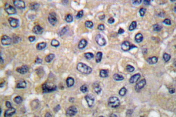 Polyclonal Rabbit anti-Human WNK1 Antibody (Tyr52, IHC, WB)