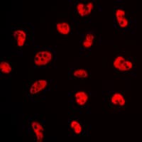 ER Alpha / Estrogen Receptor Antibody (phospho-Ser106)