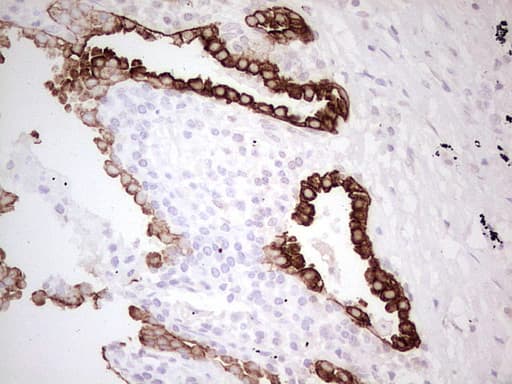 ABCB1 / MDR1 / P Glycoprotein Antibody (aa995-1280, clone OTI11D2, Carrier-free)