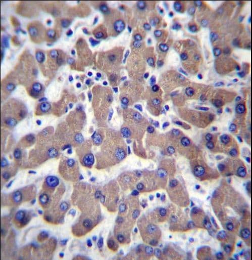 Polyclonal Rabbit anti-Human TMEM70 Antibody (aa231-260, IHC, WB)