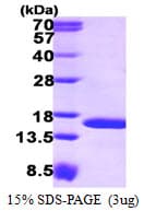 Human TAX1BP3 Protein (Recombinant His)