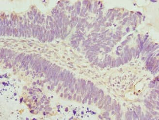 Polyclonal Rabbit anti-Human DAAM2 Antibody (IHC)