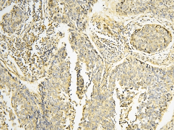 CPAMD8 / KIAA1283 Antibody