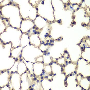 MAPK14 / p38 Antibody