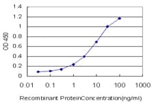 Monoclonal Mouse anti-Human CARF / ALS2CR8 Antibody (clone 2A3, IHC, IF, WB)