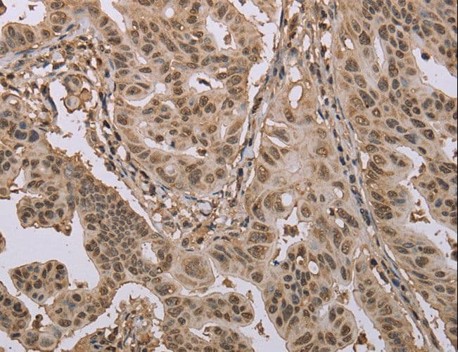 CAB39 / MO25 Antibody