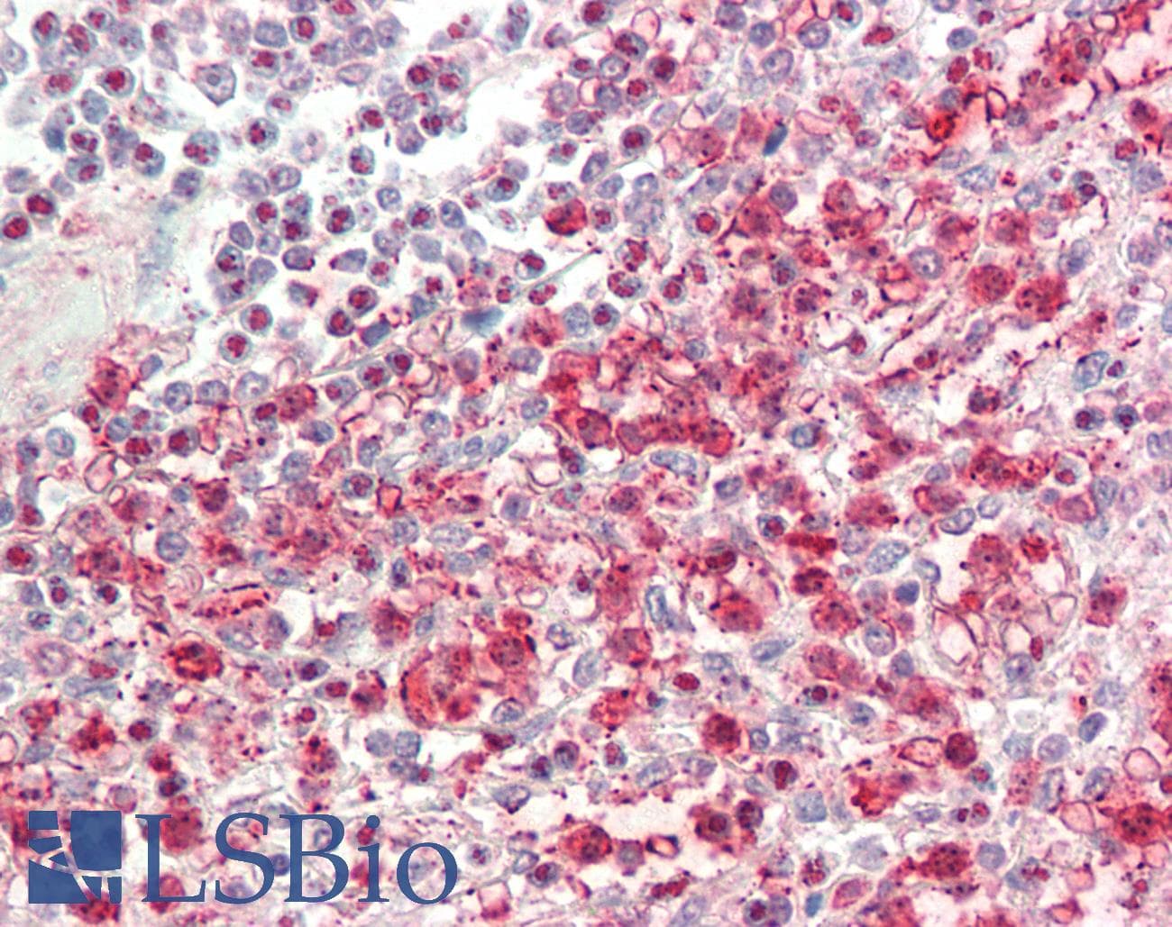 IHC-plus™ Monoclonal Mouse anti-Human SUZ12 Antibody (clone 3D10, IHC, WB)