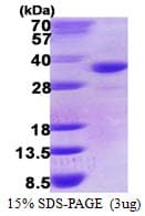 Human DHRS9 Protein (Recombinant His)