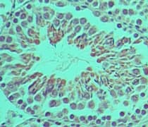 Polyclonal Rabbit anti-Mouse Ifi204 Antibody (aa70-120, IHC, WB)