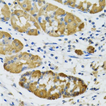 IHC-plus™ Polyclonal Rabbit anti-Human PLA2G2D Antibody (IHC, IF, WB)